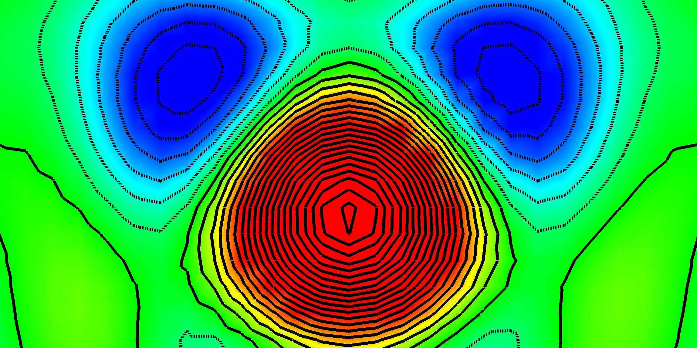 Enlarged view: nucleus density